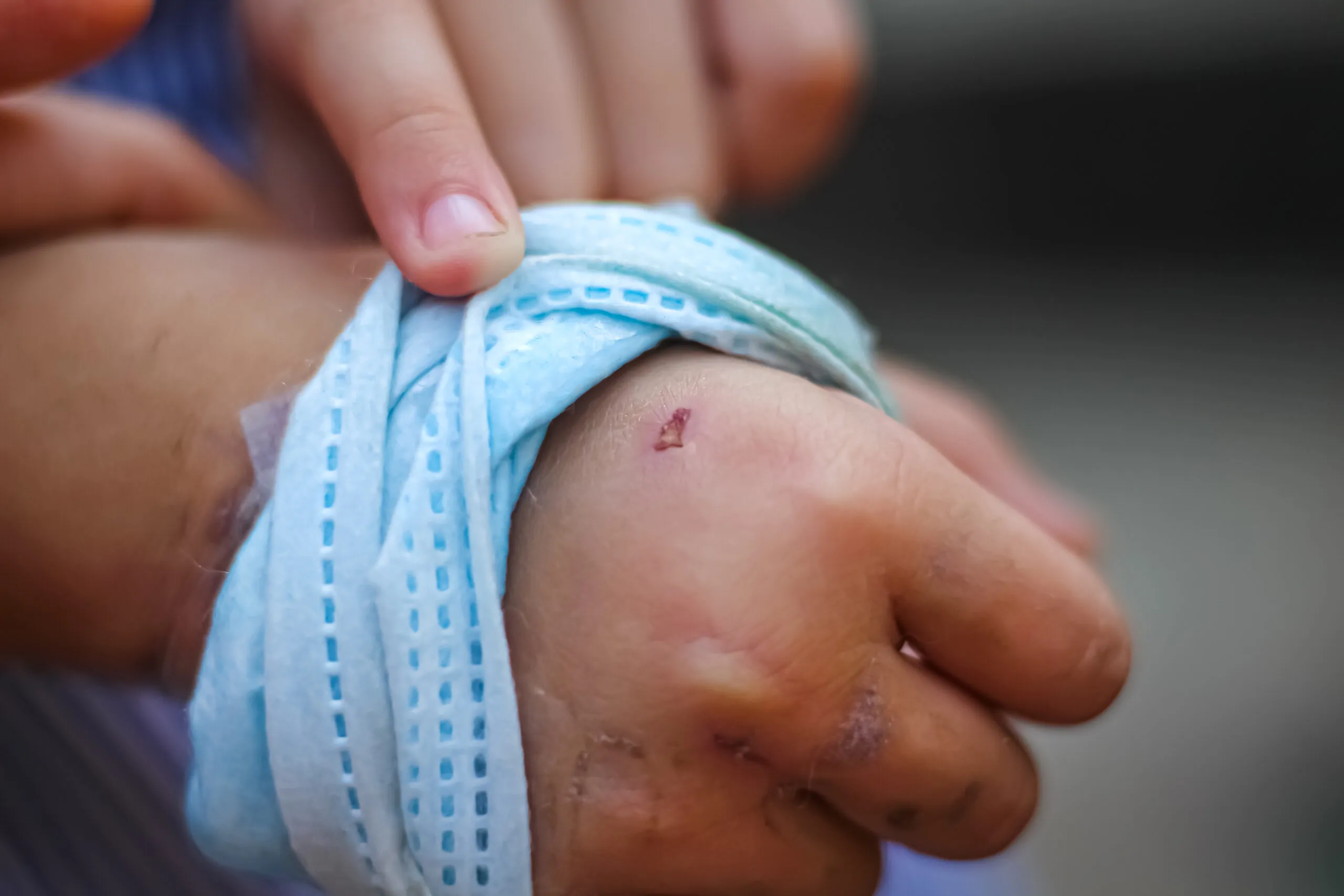 Dog Bite Laws in New York: Filing a Personal Injury Claim